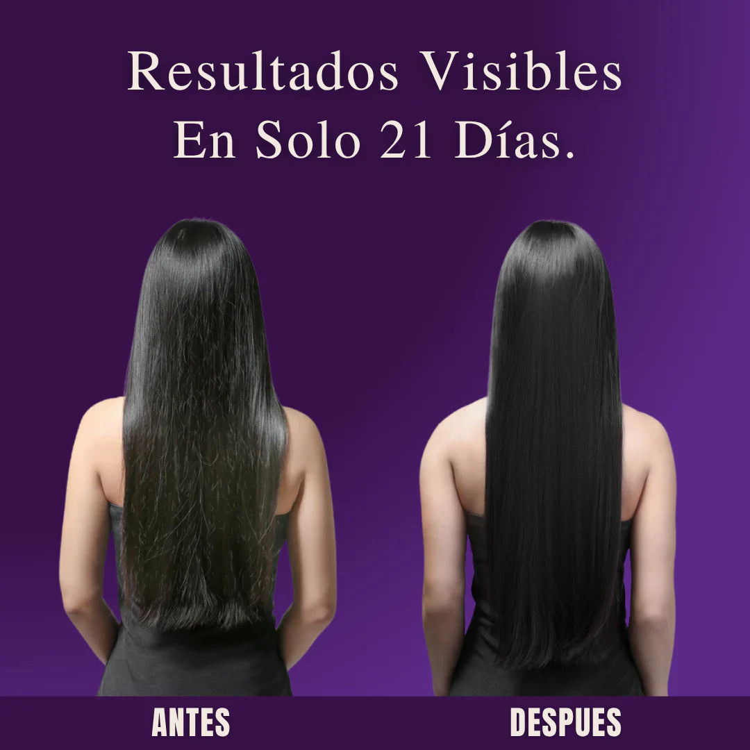 Elevant™ - Vitaminas Capilares Premium