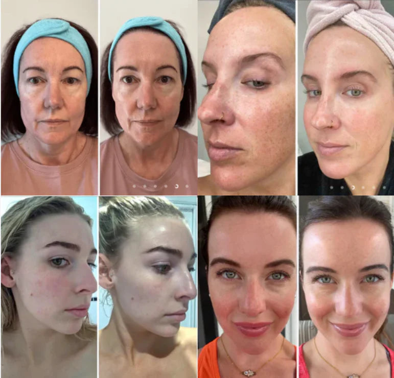 Mascarilla Coreana Nocturna de Colágeno Profundo Mask™