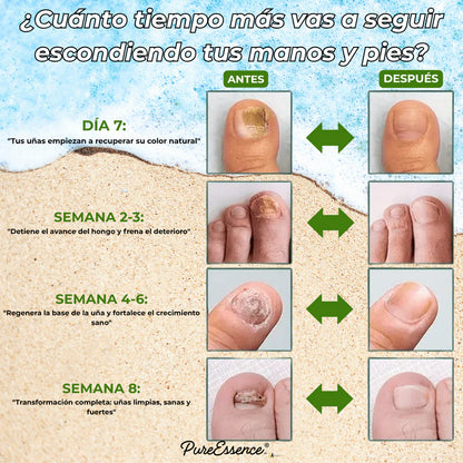 Ocultas tus uñas? PureEssence® las cambia en 7 días
