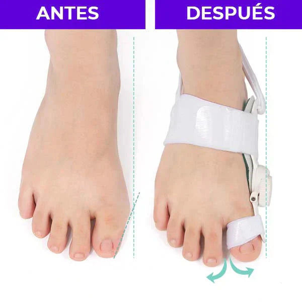 Corrector De Juanete Pro Bisagra Graduable OFERTA 2 X 1