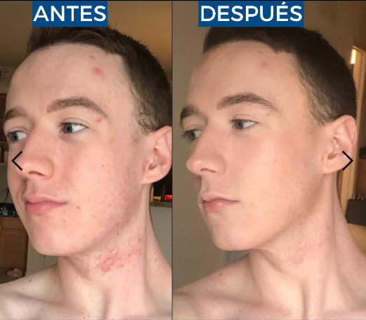 Abera Suero de retinol para hombre