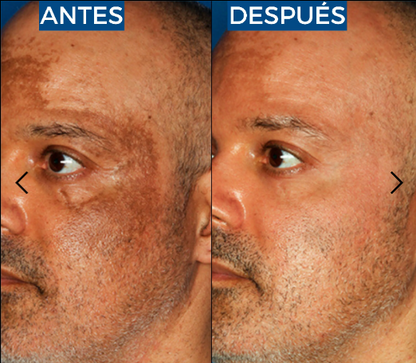Abera Suero de retinol para hombre