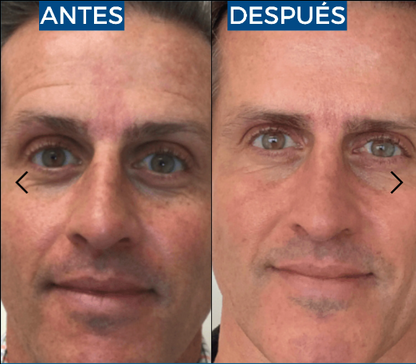 Abera Suero de retinol para hombre
