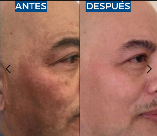 Abera Suero de retinol para hombre