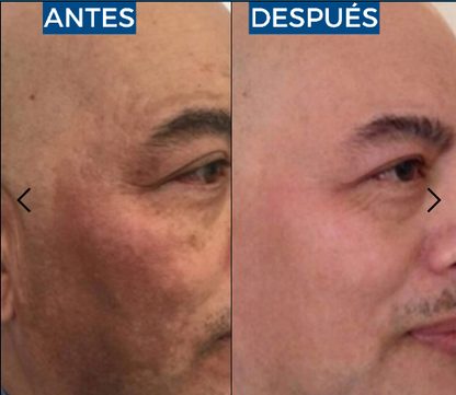 Abera Suero de retinol para hombre