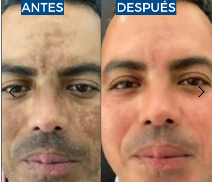 Abera Suero de retinol para hombre