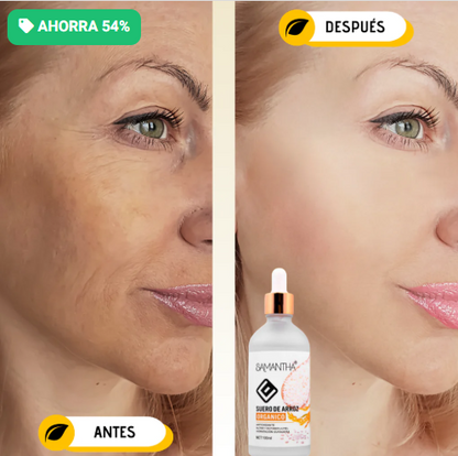 Derma Roller - Activa el crecimiento desde la raíz con microagujas