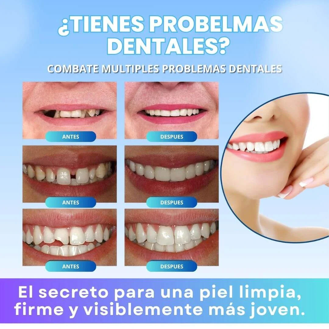 RESINA DENTAL