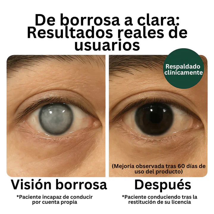 Zooone™ Suplemento de Luteína para los ojos