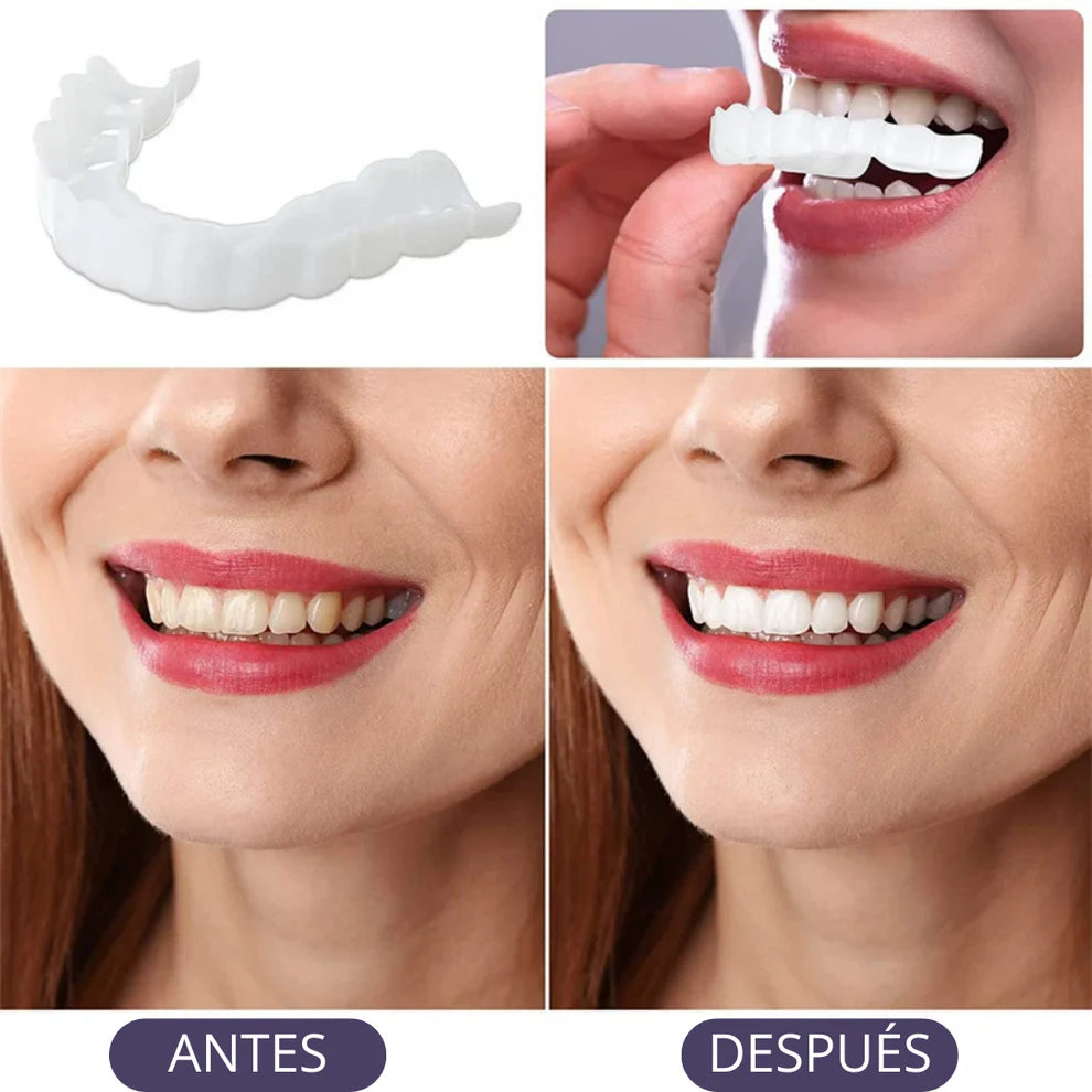 Carillas Dentales Adaptables - Transforma tu Sonrisa